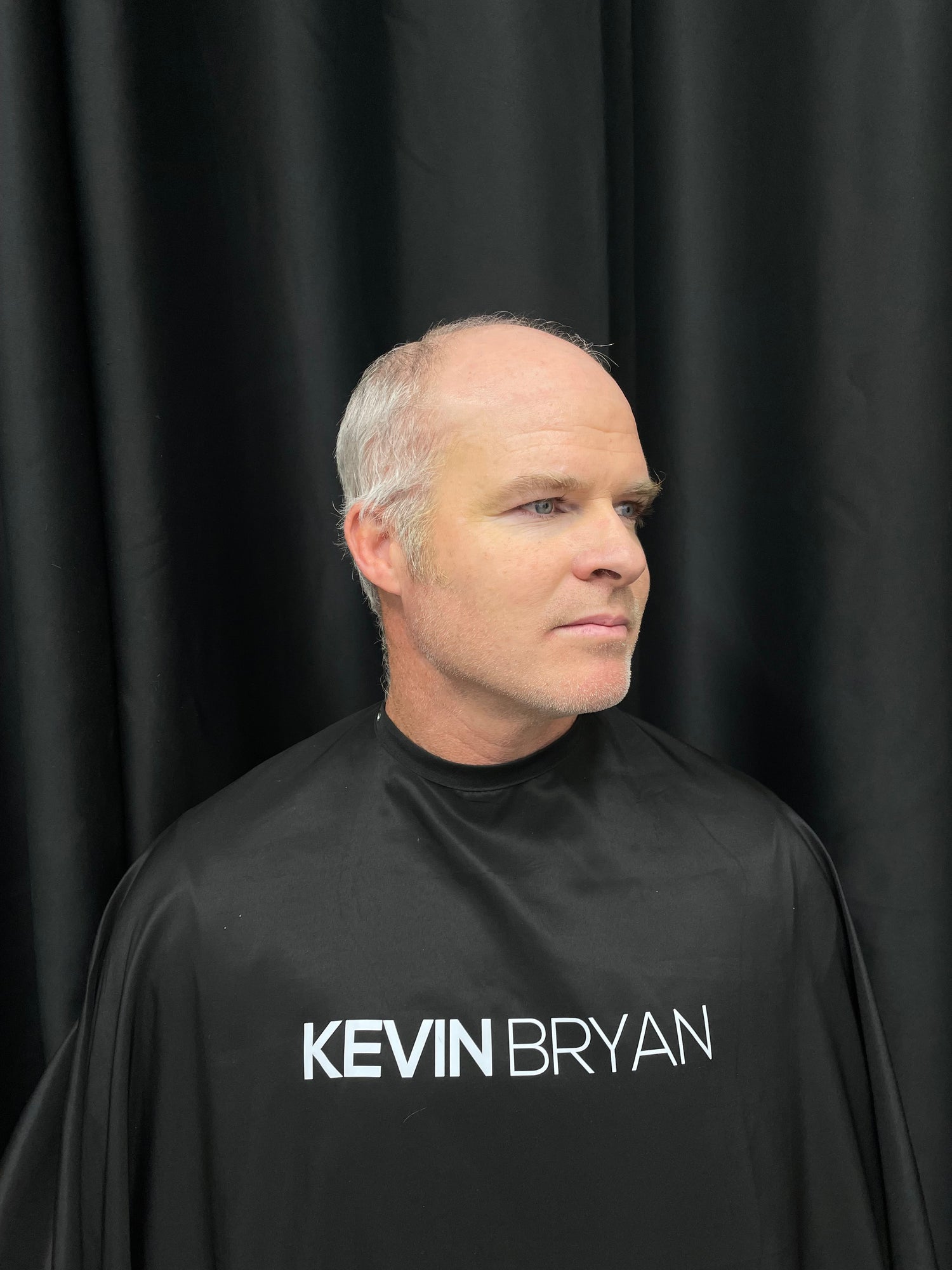 client before image with hair loss